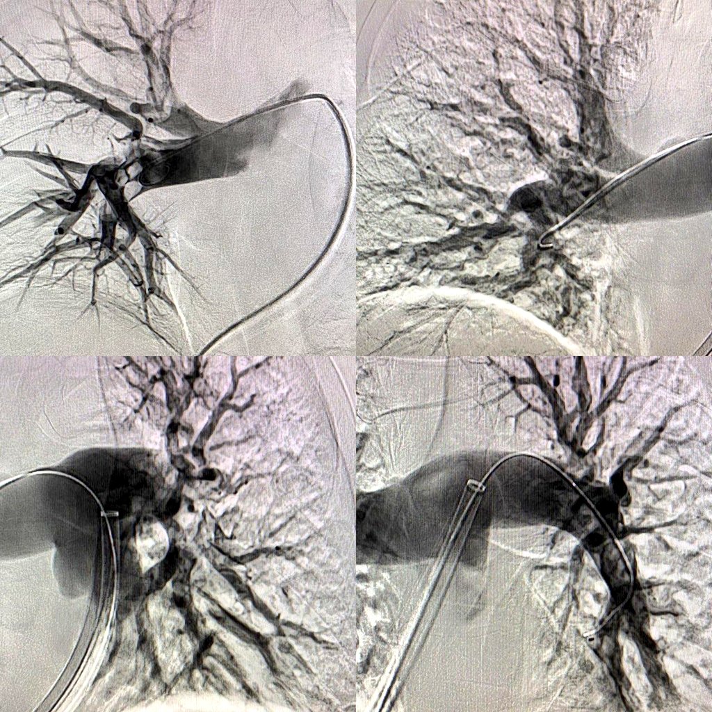 Adnan Alexander Kassier, MD. FACC. FSCAI tweet media