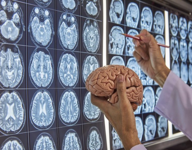 ennsaio's tweet photo. #FelizLunesATodos
Por qué al cerebro no le gusta el cambio
https://t.co/TziEyWXOQ1
@psicologiamente @Patri_Psicologa @pensarenpsicolo @JavierPsicologo @copc_cat @psiquiatriacom @_ASEPCO @Laura_Rojas_ @QbasketStCugat @sninobecerra #enacional #coronavirusarv #Covid_19 #ExtremeRule https://t.co/qOjVXx0ScG