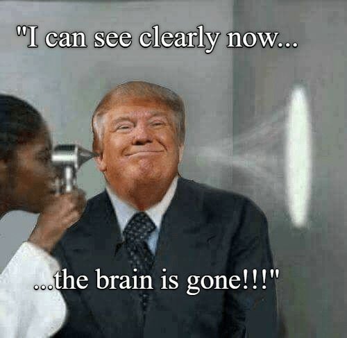 pattykvilla's tweet photo. @ProjectLincoln ...how did you find brain? 🧠I found cheese 🧀 and not much else👩🏻‍⚕️🤷🏻‍♀️ #TrumpBrain https://t.co/OEZ1kMLsXw