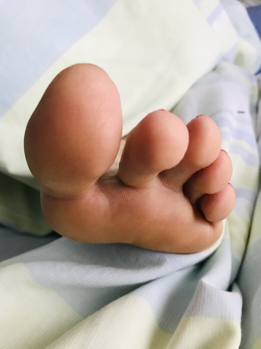 gs_sepi's tweet photo. Good Morning!!! 😛😛😛 #feetpic #feetnation #feetlove #feetfindom #feetmaster #toes #feet #solesfeet #soles #feetcurves #feetfetish #footslaves #longtoes #higharches #prettytoes #sexyfeet @ukprettyfeet @BritFootBabes @iloveredtoes https://t.co/GidDsY5MRG
