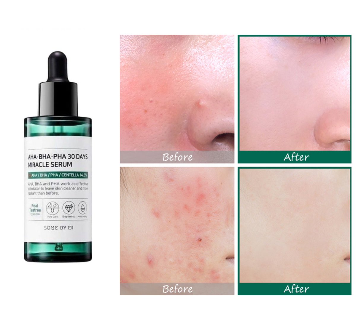 ordinary face moisturiser