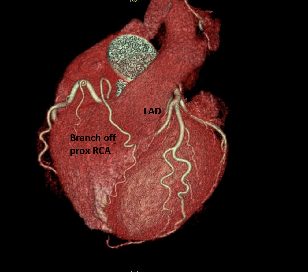 Seth Uretsky tweet media