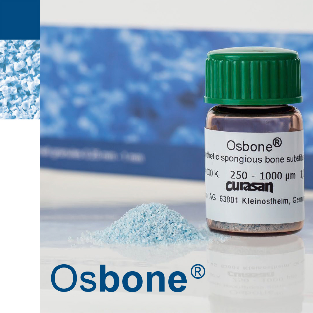EckermannLab's tweet photo. Hoy te presentamos Osbone: la estructura perfecta para una regeneración ósea estable.

Más detalles sobre ésta alternativa segura:
https://t.co/vfkK0nHyHy

#implante #implantologia #implantology #implantes #eckermann #eck #osbone #oseo #boca #encias #regeneracion https://t.co/oZ4AZFYx7d