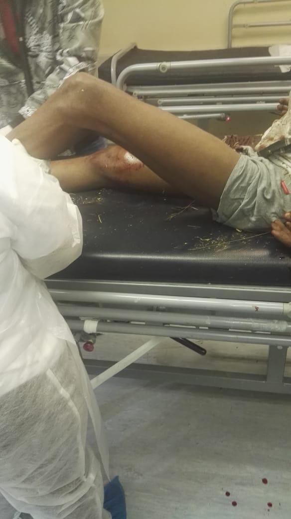 KG_Ka_Zilonde's tweet photo. Bra @tumisole please assist this gentle man, who was taken from his home in the early hours of Sunday by Kwa Mhlanga Police Officers. He was then taken from Kwa Mhlanga to Valbank, assaulted and then shot twice before been left there in a vele.@MbuyiseniNdlozi https://t.co/NMoGHzM0eW