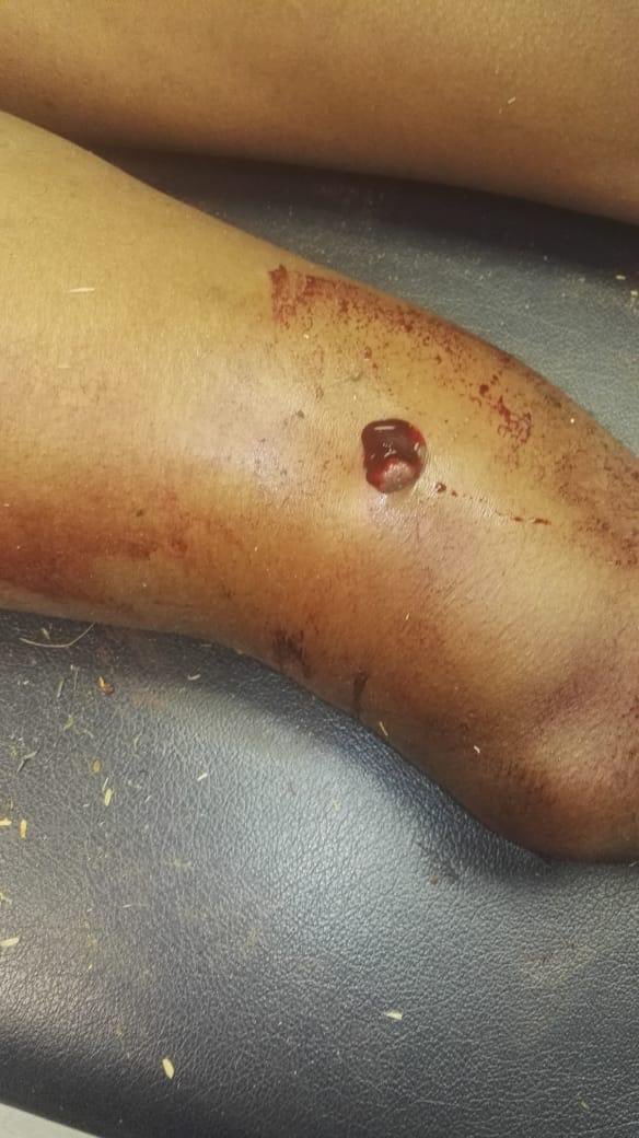 KG_Ka_Zilonde's tweet photo. Bra @tumisole please assist this gentle man, who was taken from his home in the early hours of Sunday by Kwa Mhlanga Police Officers. He was then taken from Kwa Mhlanga to Valbank, assaulted and then shot twice before been left there in a vele.@MbuyiseniNdlozi https://t.co/NMoGHzM0eW