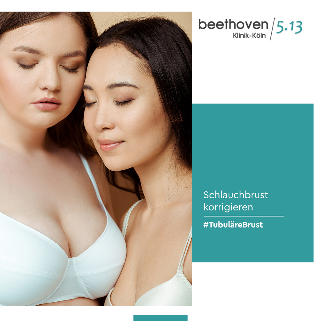 BeethovenKlinik's tweet photo. Bei der #schlauchbrust handelt es sich um eine äußerst häufig auftretenden Brustfehlbildung. Wann eine Korrektur nötig ist und welche Operationsverfahren Ihnen zur Verfügung stehen finden Sie auf unserer Webseite. https://t.co/q0vFaf7oeK #beethovenklinik https://t.co/WQAkadqr25