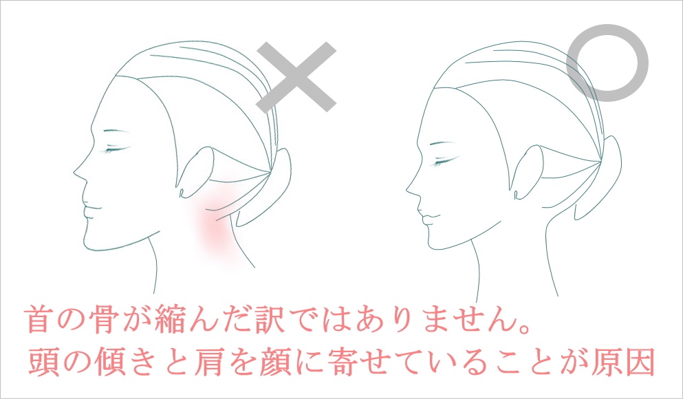 小顔のつくり方 レメディオ戸塚哲春 短い首を長くする方法 身長伸ばす方法 首が伸びていると 顔が胴体より前に出てないと 顔は小さく見える もちろん首が伸びていると首は細い