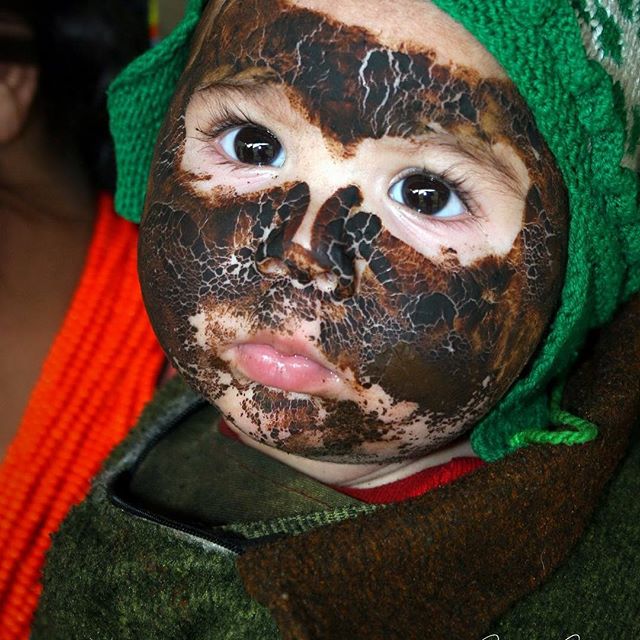 A kid with a traditional face mask made from crushed goat's horns, Chitral 