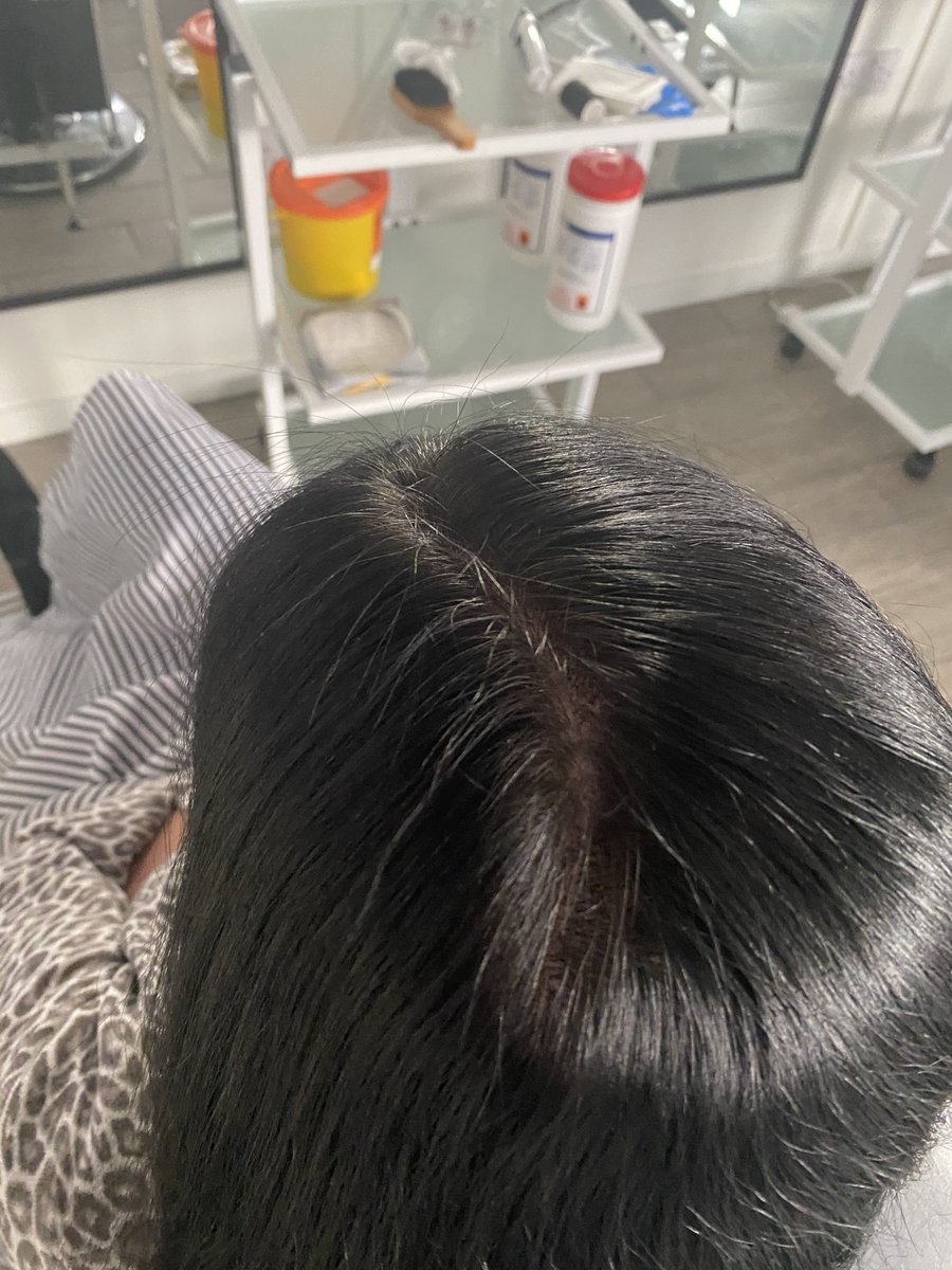 #scalpmicropigmentation is the fastest growing solution for hair loss in recent history!  We have 32 different shades of ink, which our talented aestheticians will perfectly match to your natural hair colour!