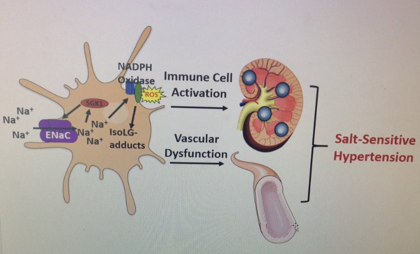 annetkiraboc1's tweet photo. So honored to receive the Hypertension Top Paper Award! Thanks editors for choosing our work. We found dendritic cells mediate #kidney damage and salt sensitive #hypertension via SGK1. ⁦@UofGVPAnna⁩ ⁦⁦⁦@AHAScience⁩ @AHAMeetings⁩ ⁦⁦@VUMCResearch⁩ https://t.co/anHJfH4spZ