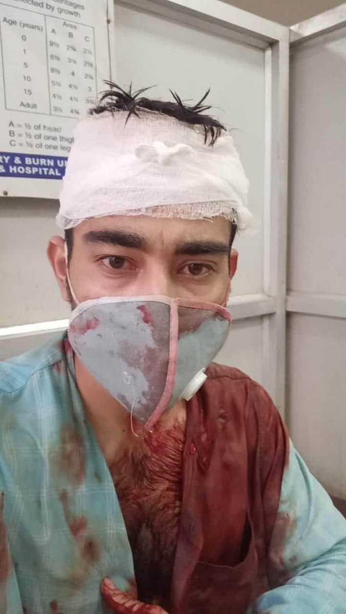 AAP4Assam's tweet image. AAP Assam volunteer namely Rajesh Chetri was brutally beaten by GMCH security guard just because he has raised his voice for not using infrared thermometer for screening the visitors. Govt must take strict action against this @PMOIndia @himantabiswa @assampolice @sarbanandsonwal