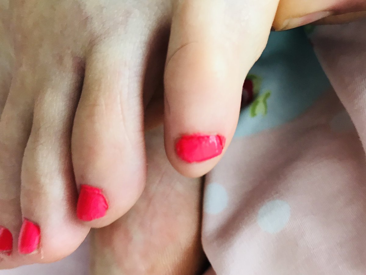 gs_sepi's tweet photo. Baby-Toe Anyone? 😛😛😛 #feetpic #feetnation #feetlove #feetfindom #feetmaster #toes #feet #solesfeet #soles #feetcurves #feetfetish #footslaves #longtoes #higharches #prettytoes #sexyfeet @ukprettyfeet @BritFootBabes @iloveredtoes https://t.co/20DXk40V5k