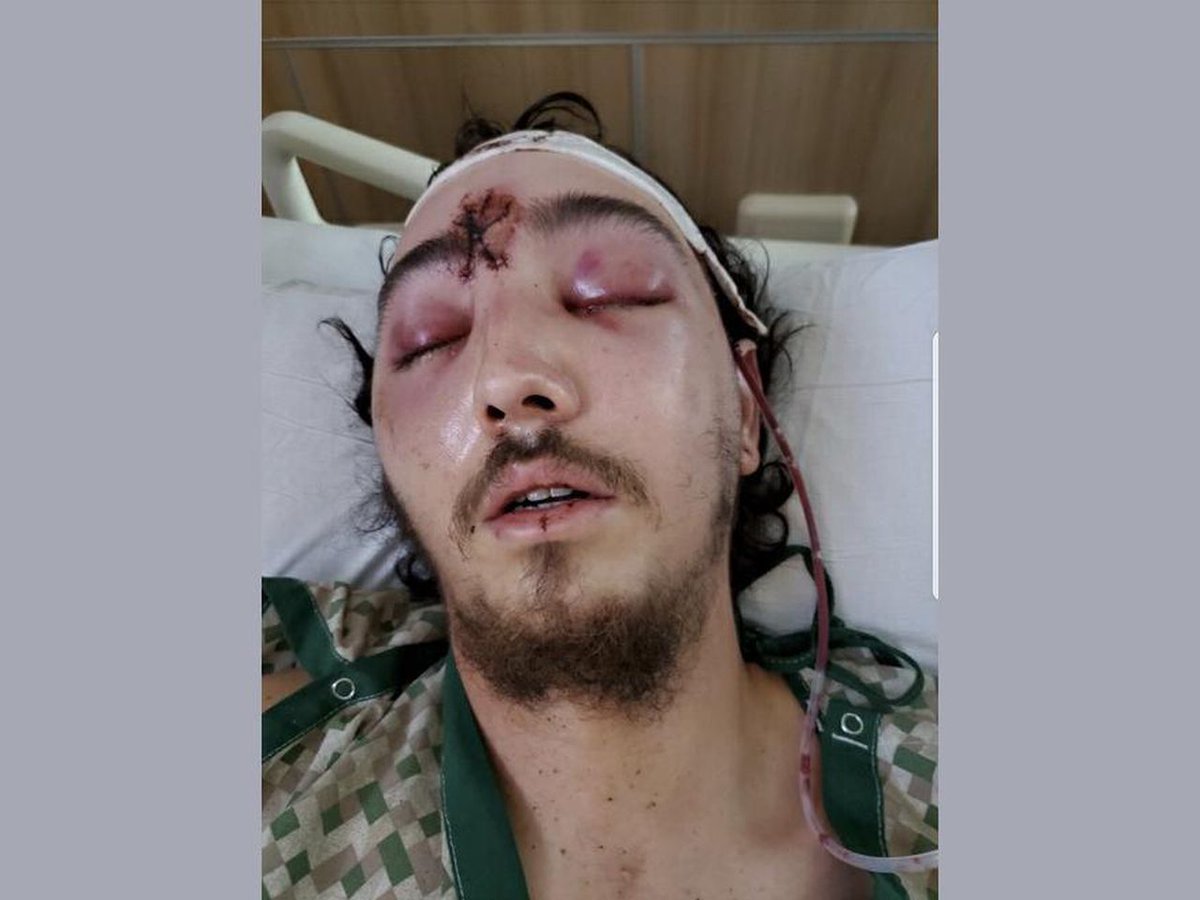 Oregonian's tweet photo. Donavan La Bella making ‘remarkable’ recovery from head injury after being shot by feds, sister says https://t.co/zc0SUGXqIz https://t.co/9SVv35QAa6