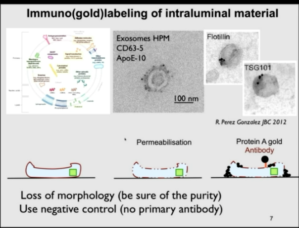 KennethWWitwer's tweet photo. The use of #Immunogold in #TEM can be quite useful...and not just for surface markers...can also permeabilize. Always remember good controls! https://t.co/krgMn38453
