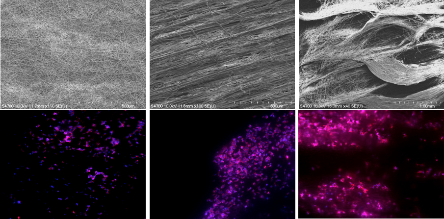 mtu_engineering's tweet photo. Cancer #metastasis and #wound healing. Opposite sides of the same coin? Find out tonight at 6pm EST from Dr. Smitha Rao @michigantech. Her tenacious research team develops biomedical #microdevices from electrospun fibers. #Engineering #nano https://t.co/ejvlRC0yNN #mtubound #STEM https://t.co/Vsep1Y96uW