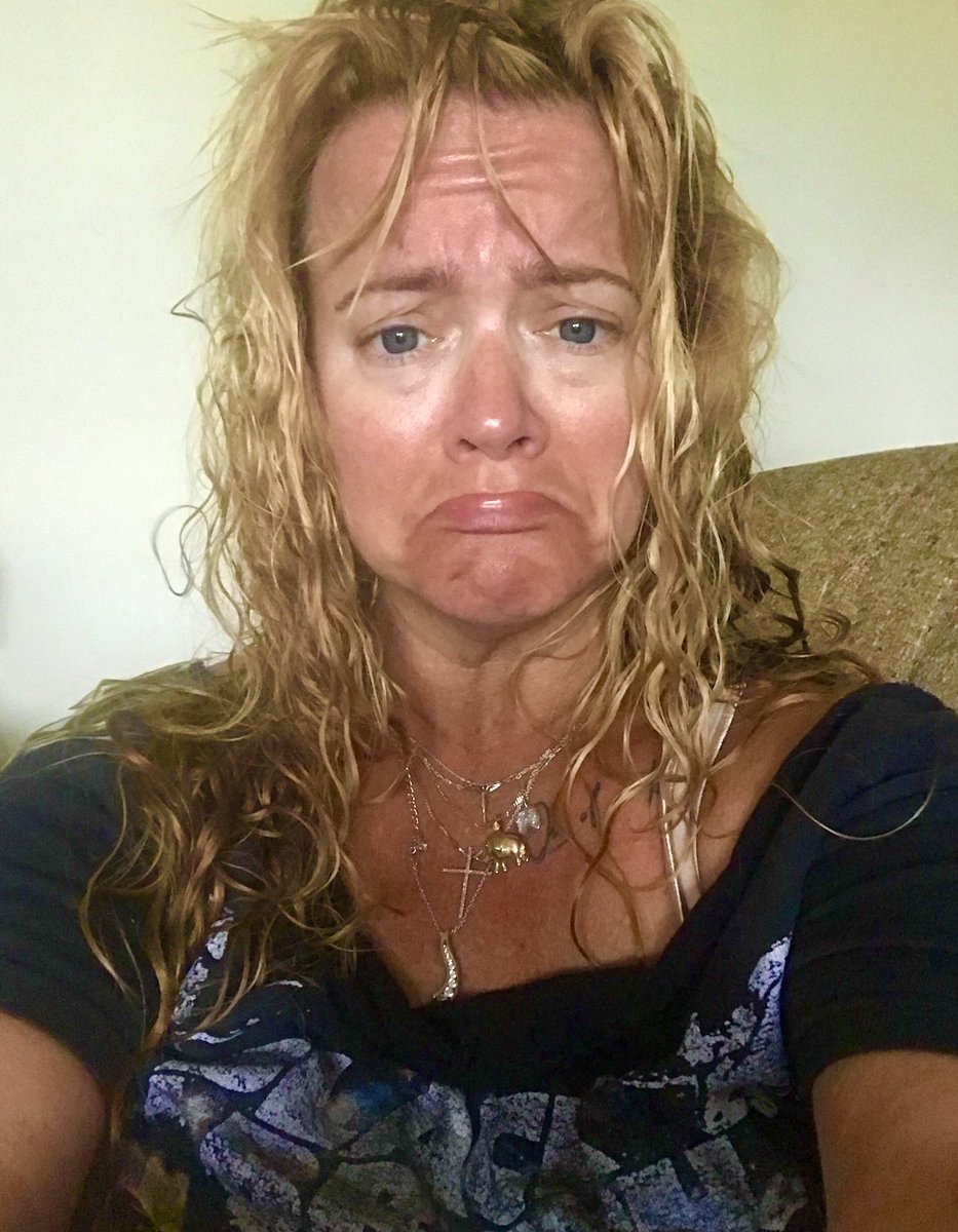 _WendyJenks's tweet photo. THIS is why you should wear sunscreen. I actually look better than this morning. Thank GOD for Josie Maran’s Argan Oil #MiracleinaBottle https://t.co/ybTS88k5v0
