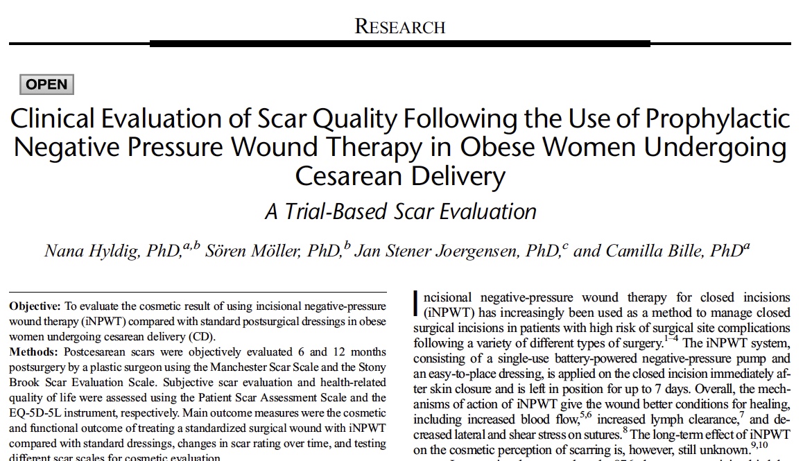 NHyldig's tweet photo. FINALLY - Last paper published of a study evaluating the effect of iNPWT (PICO @SmithNephewPLC) to reduce surgical site infections after c-section in obese women. Overall, the study consists of a RCT, a trial-based economic evaluation, and a long-term scar evaluation. #NPWT https://t.co/zldh54kwEH