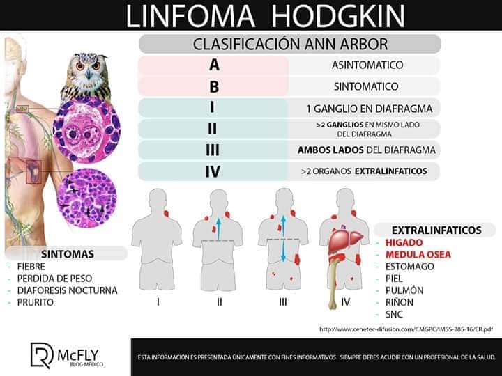 Ameemcti On Twitter Linfoma Hodgkin