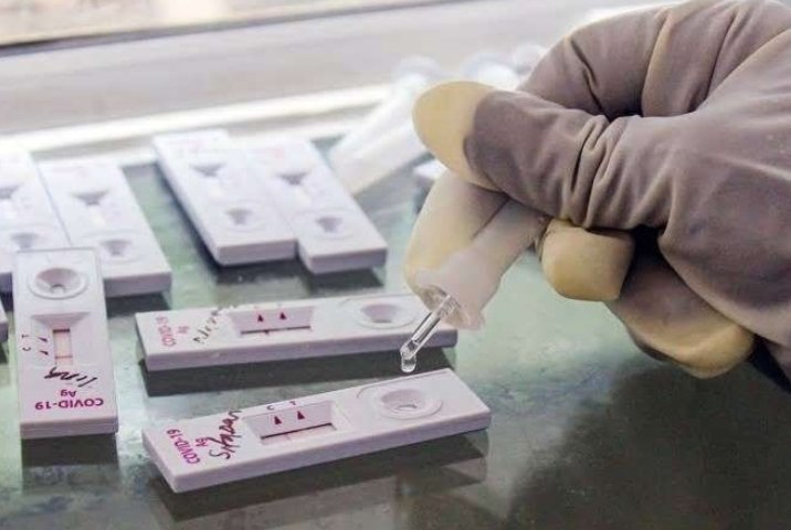 rohit_matek's tweet photo. There is an increase in #COVID19  case because there has been an increase in testing. If more people took IQ test there would be increase in Idiot too. 
#coronavirus 
@RT_Himachal 
@ANI 
@MoHFW_INDIA 
@PTI_News @IndianExpress @PMOIndia https://t.co/Mf9OJj6euL