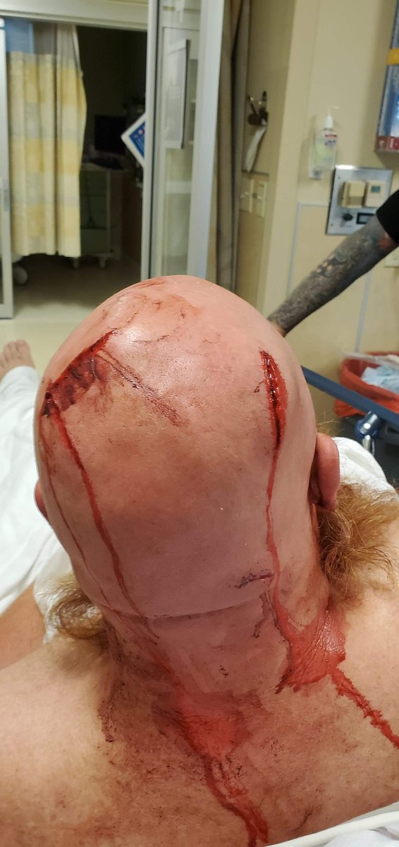MrAndyNgo's tweet photo. The Sacramento cell of antifa, part of a network of violent militant antifa groups in US, has created merchandise &amp; propaganda in support of Gage Halupowski. The man is one of the few antifa convicted for assault in Portland. He nearly killed Adam Kelly in an unprovoked beating. https://t.co/J1qw8F2NYd
