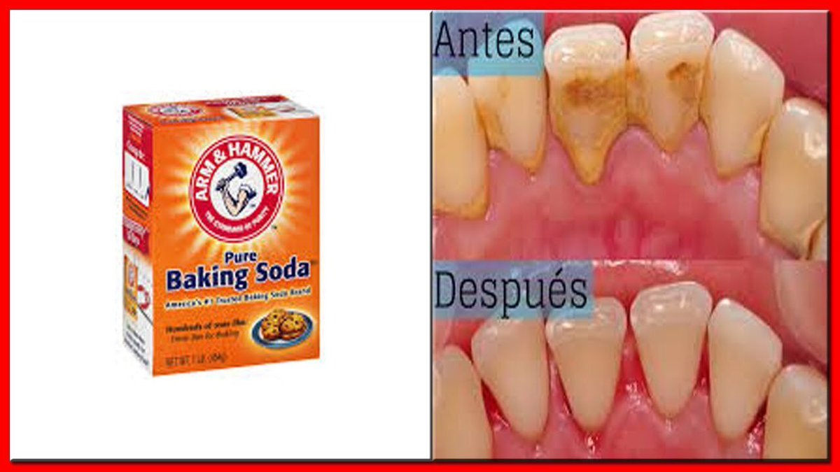 Como QUITAR el Sarro💩 de los Dientes 👅/NO ES BROMA QUITA EL SARRO DE LOS... youtu.be/maZiU7JPZHo vía <a href="/YouTube/">YouTube</a>