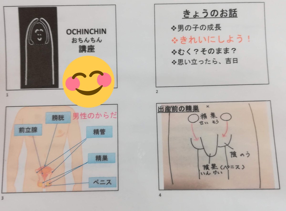 むきむき体操の情報まとめ Dr リノ先生 Awaguni Deko8のご意見です 小児科医です ムキムキ体操はお勧めしません このパンフだと 男の子の親は誰でもやらないといけない と誤解を広めてしまいます 亀頭包皮炎や尿路感染を繰り返している子 包茎