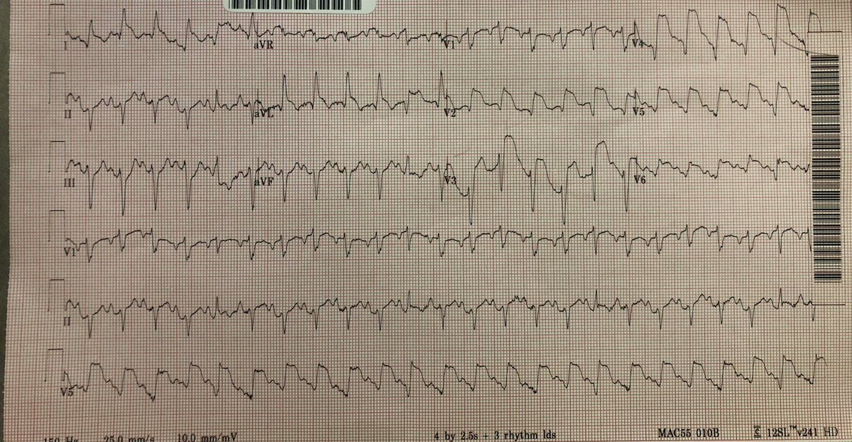 Amir Kaki, MD tweet media