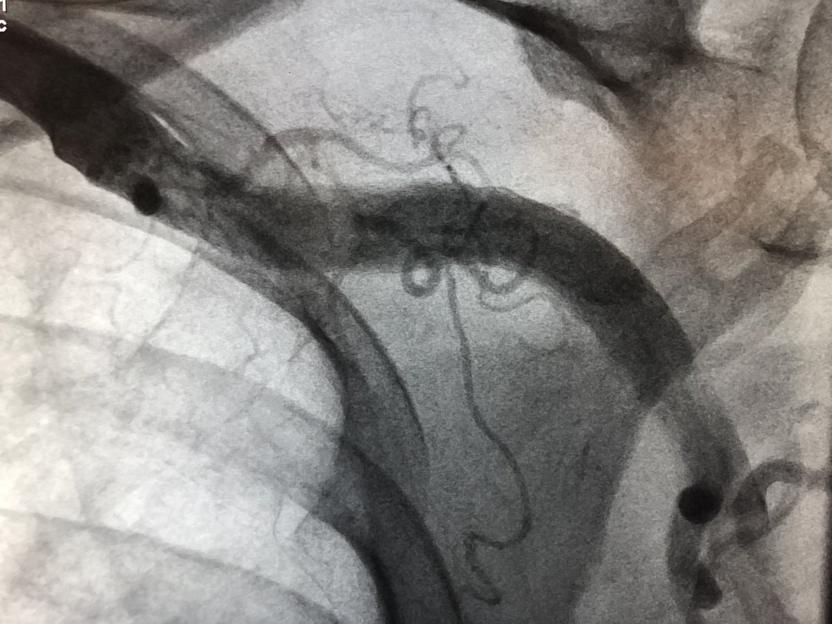 Amir Kaki, MD tweet media