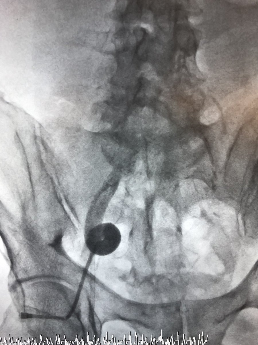 Amir Kaki, MD tweet media