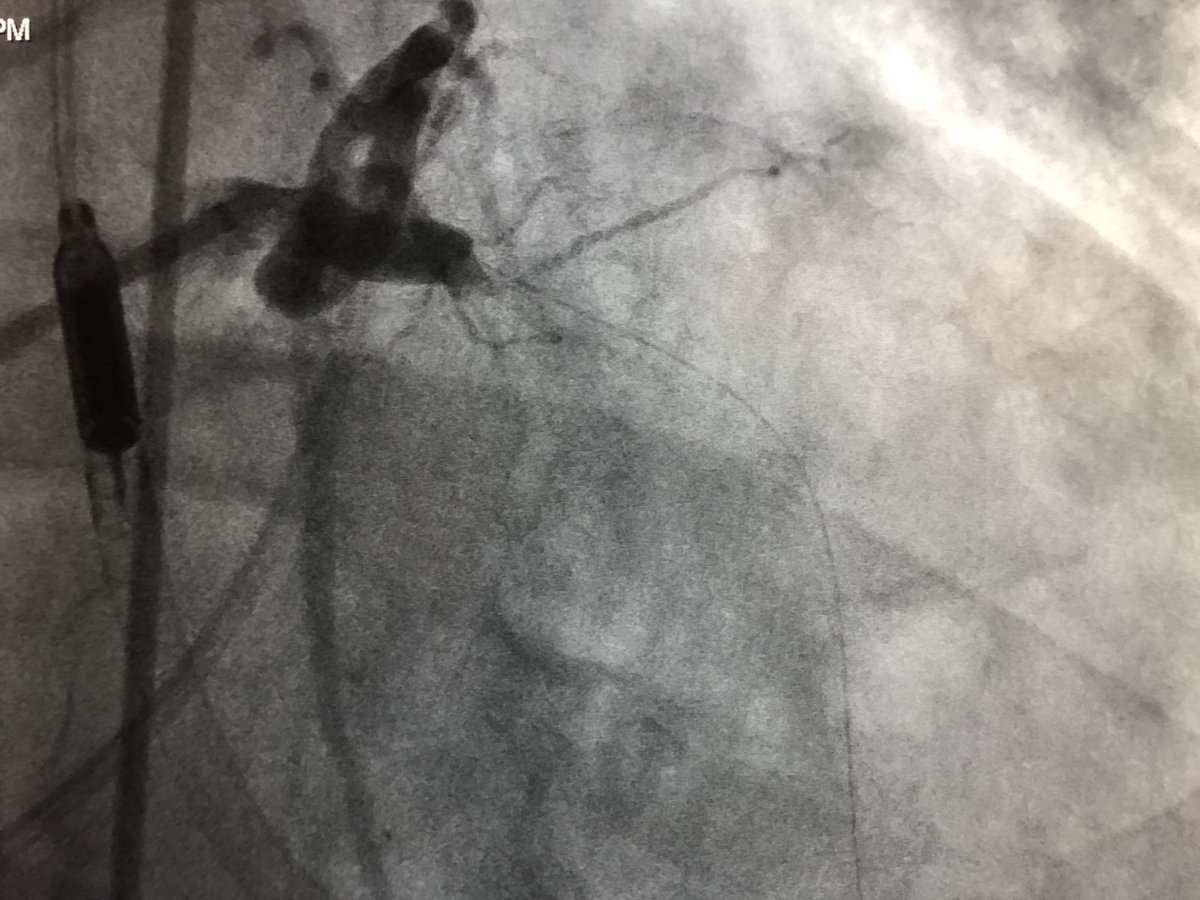 Amir Kaki, MD tweet media