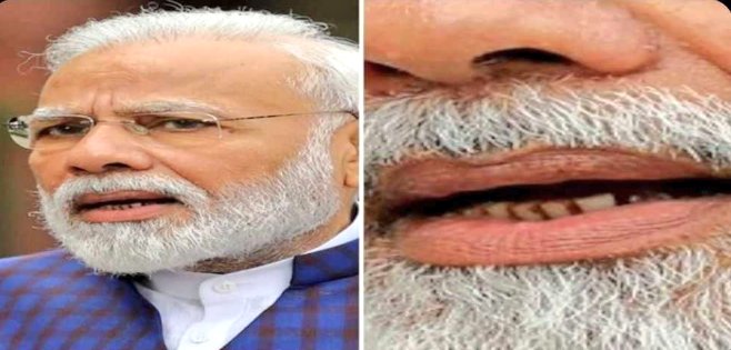 DrOmPrakashB's tweet photo. Dear @narendramodi sir, please do visit a Dentist after this pandemic gets over https://t.co/K4QKZPWU2P