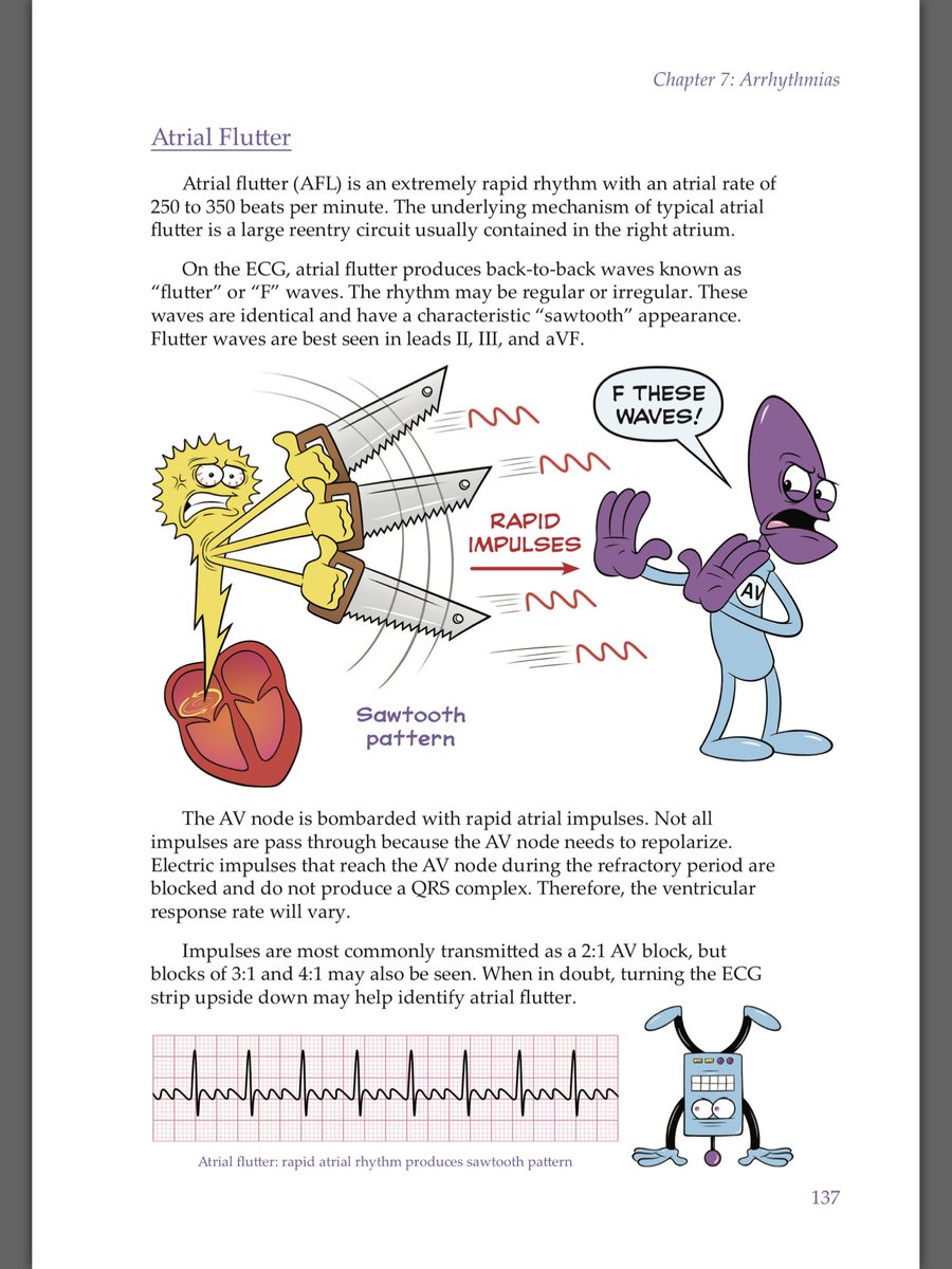 purpleparamedic's tweet photo. Added yet another ECG book to my collection, the illustrations in this one are really fun. #Iwilllearn https://t.co/o5omNjenkT