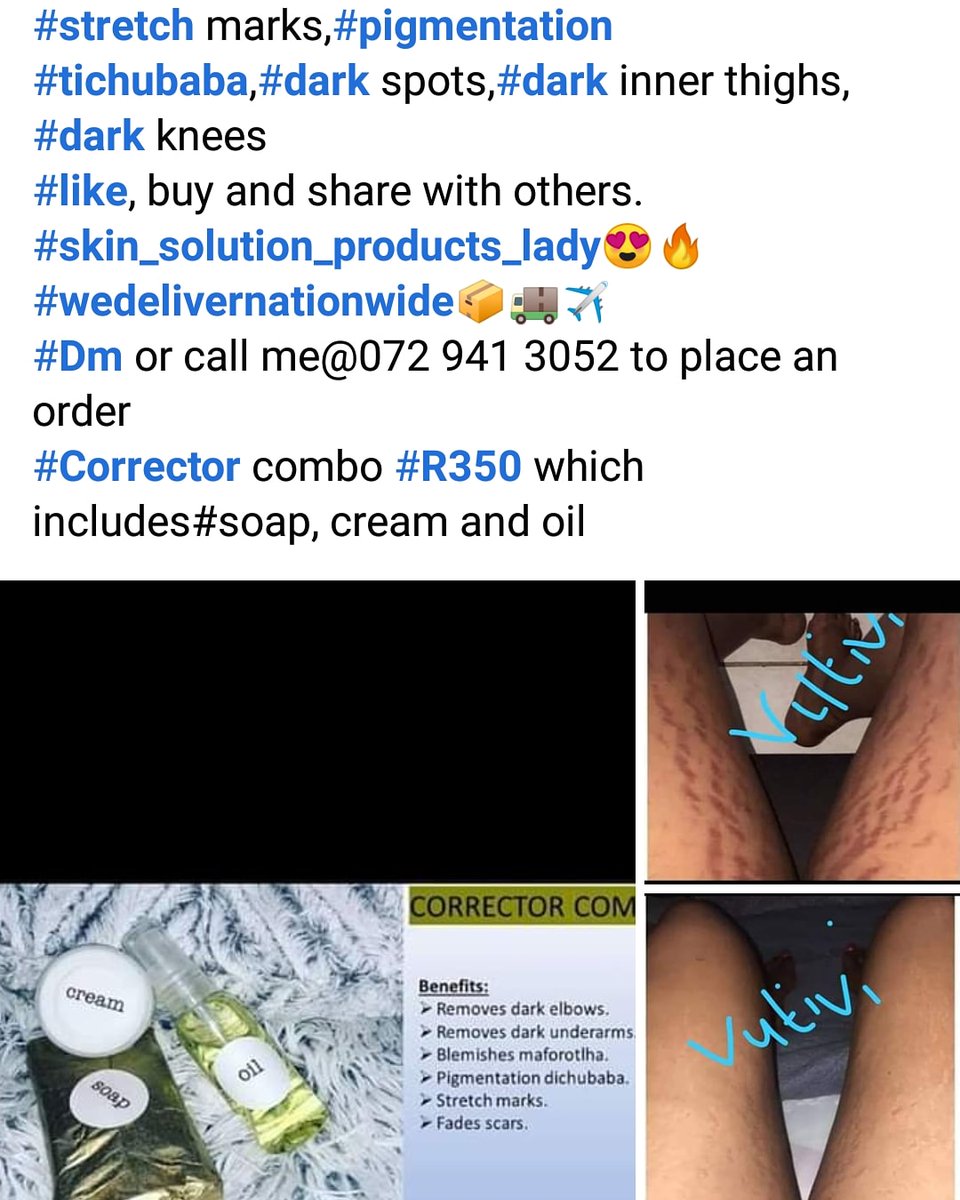 _VutiviM's tweet photo. #GirlTalkZA
#HappyTuesday ladies with skin problems, try our products today and enjoy the benefits below
#Dm or call skin solutions products lady β¬οΈ
#chooseday #TsongaDrive
#zodwa #JobSeekersSA #ShakaMustFall #COVID19 https://t.co/2b8yJqSQTd