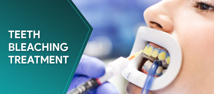 MartinElsia's tweet photo. 🔥3 Methods Of Teeth Bleaching Treatment🔥
The appearance of your teeth has a great impact on your overall appearance. People who have bad shaped or discolored teeth usually...
👉https://t.co/8zdO4bqEKX
#teethbleaching #teethwhitening #dentistry #dentists #londonteethwhitening https://t.co/pJIflHRQJH