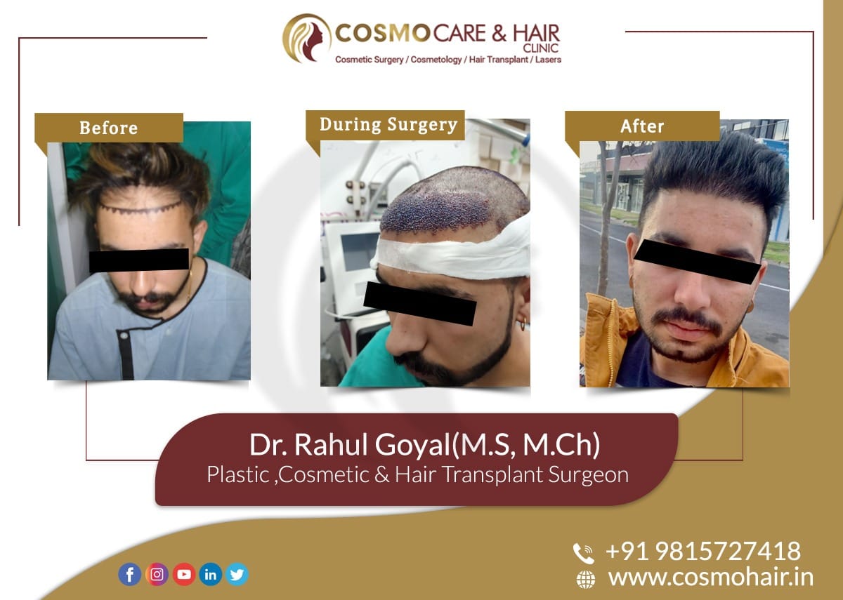 Cosmo Care & Hair Clinic on Twitter: Cosmo Care & Hair Clinic on Twitter: