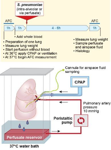 AJPLung's tweet photo. New #ResearchArticle in AJP-Lung: THE EX-VIVO PERFUSED HUMAN LUNG IS RESISTANT TO INJURY BY HIGH-DOSE S. PNEUMONIAE BACTEREMIA.
Read more here: https://t.co/MlqnXfQmZW
#Sepsis #Shock #AcuteLungInjury #ARDS #EpithelialInjury https://t.co/F7D3fkJeCL