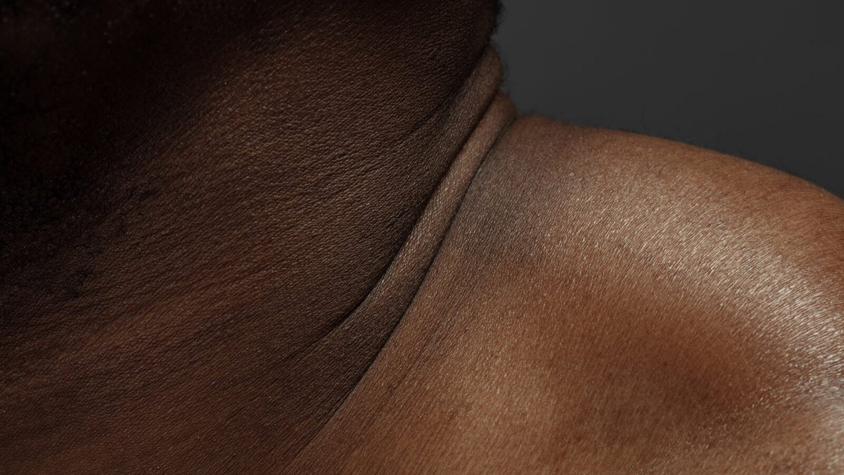 To begin addressing racial bias in medicine, start with the skin. "Racial inequity in the U.S. health system is, in many ways, far deadlier than police violence." VisualDx CEO Dr. Art Papier addresses healthcare inequity in this op-ed in <a href="/StatNews/">STAT</a>. bit.ly/32FzJz6