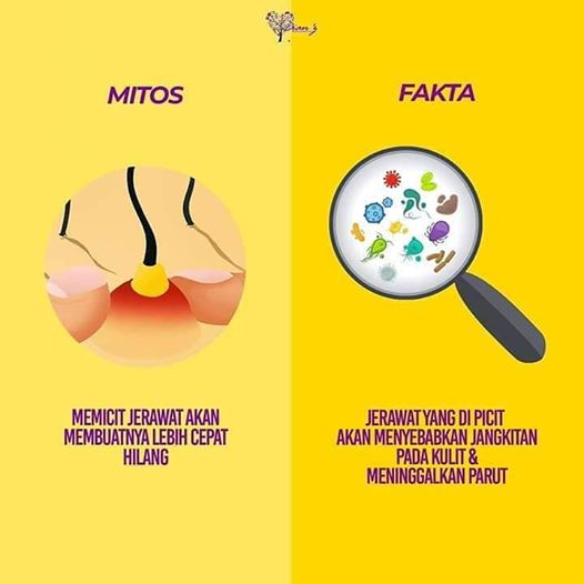 Siapa suka picit jerawat? Kita boleh jadi gengCuba tag kawan kawan yang suka picit jerawatTau tak apa kesan dia?