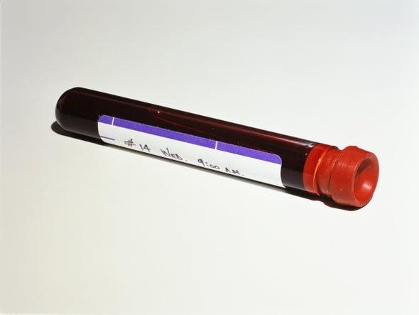 sciam's tweet photo. Experimental blood test detects cancer up to four years before symptoms appear https://t.co/uClMSGma2Z https://t.co/RKcXDdmkaf
