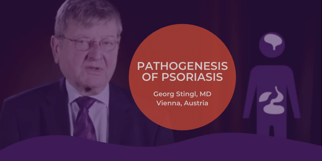 IpcPs's tweet photo. Austrian #dermatologist, Georg Stingl, MD, discusses differences in the #pathogenesis of #plaque #psoriasis and #pustular psoriasis in this video from IPC. Spoiler alert: it's the neutrophils. Watch: https://t.co/UVFLZmswmZ https://t.co/yIDyrNZeP3