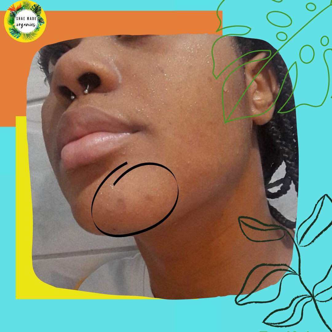 shaemadeorganic's tweet photo. Preorder today 💛
Properties of the OG Soap Bar:

🌱Reduces swelling and inflammation  of the skin

🌱Acne prevention

🌱Kills bacteria

🌱Exfoliant

🌱Anti-aging

🌱Relieves skin itching 

Only $600 JMD
#shaemadeorganics
#smo #smallbusines https://t.co/LpnRSicFQY