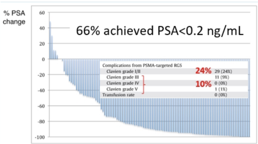 urotoday's tweet photo. Treatment of recurrent lymph node metastatic #ProstateCancer - Surgery is the best option. #EAU20 presentation by @joniau @KU_Leuven. Written coverage by  @zklaassen_md @GACancerCenter on UroToday > https://t.co/aZaBNrPxKY @Uroweb https://t.co/a4pIJztFbA