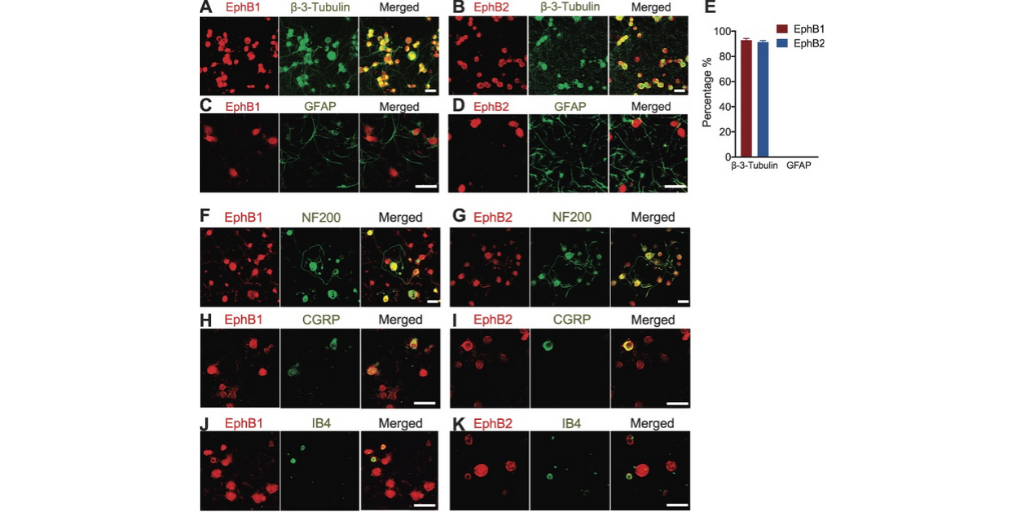 PAINthejournal's tweet photo. This #PAINJournal article suggests #EphB receptor activation facilitates Ca2+ influx through N-methyl-D-aspartate receptor dependent and independent manners in #DorsalRootGanglion neurons. https://t.co/VTtZEGMqkA https://t.co/iFqVZJOnLc