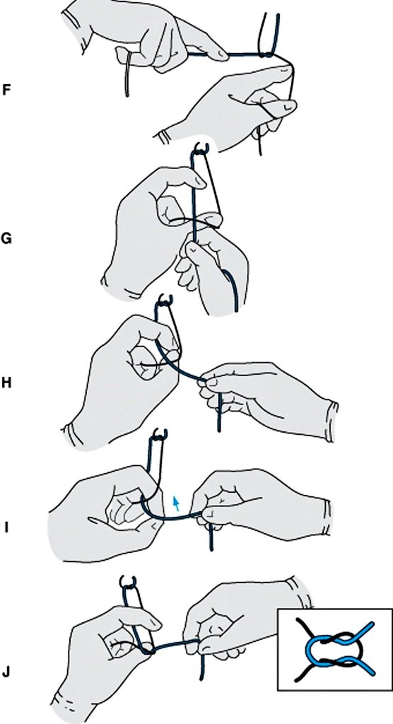 X पर Dr. Johnny Stewart. MD , FRCSC / RMC, CAF: Technique for tying two-handed  square knot!! #SoMe4IQLatAm #SoMe4Surgery  / X