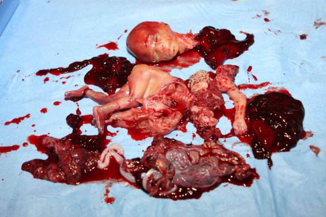 NicolasCarnogu1's tweet photo. @ErinOTooleMP Have you seen a picture of an abortion? Why is this not your primary issue? This is Murder.... https://t.co/j2Zbpvg1Ls