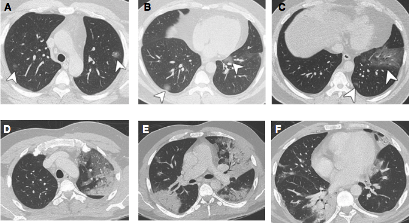 RadiologiaChile's tweet photo. Envía tus trabajos científicos, artículos originales, revisiones y series de casos a la Revista Chilena de Radiología. La Revista se publica cuatro veces al año y se encuentra indexada en Scielo.
Instrucciones aquí: https://t.co/7gUKQI4XkN
#sochradi #Revista #RevChilRadiol https://t.co/zV7vwbn2qH