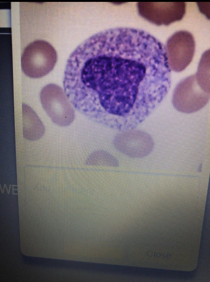 EdirisingheNee's tweet photo. Love you too 💓 #haematology #morphology #microscopy #masters #labmed #bloodcells #university #unistuff #science #cellavision #cellclassification #celldifferentials https://t.co/Ff6HjtRG7z