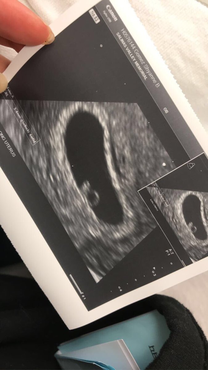 sweetheartshyy's tweet image. this WAS my boyfriend Andrew Rodriguez.I gave him my all He gave me a concussion,seizure and left me in the hospital hemorrhaging in my insides.all while I’m pregnant with his baby.He got a lawyer bc he beat me.Im8weeks pregnant.He beat me and now hes getting away with it.