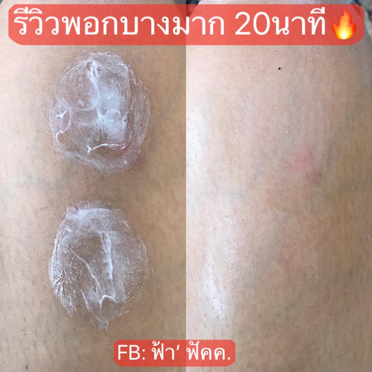 primpink_shop's tweet photo. ขาไหม้ ดำแดด จบปัญหาด้วยเซ็ตพอกโสม 🤟🏻🌈💜 https://t.co/Z0zFojzFTc