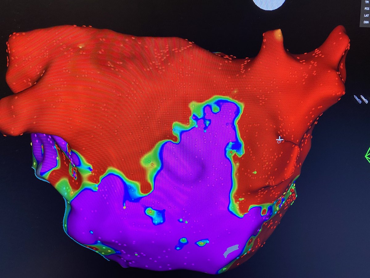 Imdad Ahmed,MD tweet media